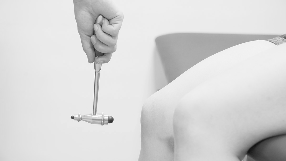 Schwarzweißfoto: Hand hält einen Reflexhammer über dem Knie einer Patientin, um den Patellarsehnenreflex zu prüfen.